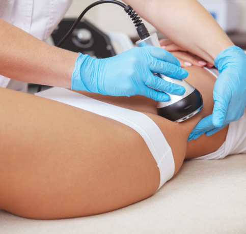 Non-surgical body contouring treatment using ultrasonic cavitation device on thigh for fat reduction at Access Beauty 4U in Frisco, Texas.